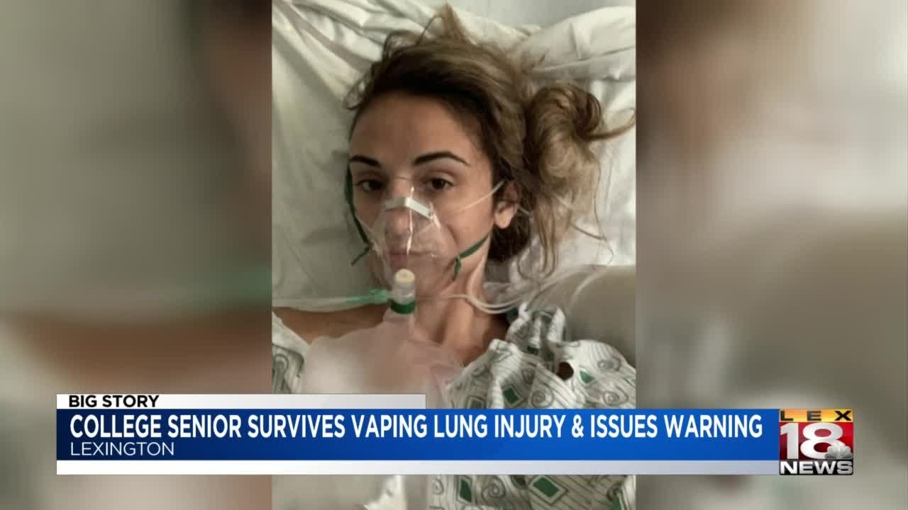 'I almost died': Local college student warns against vaping, spent eight days in the ICU