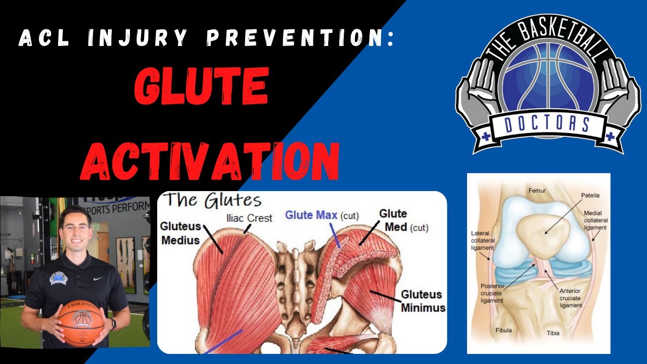 ACL Injury Prevention: Glute Activation