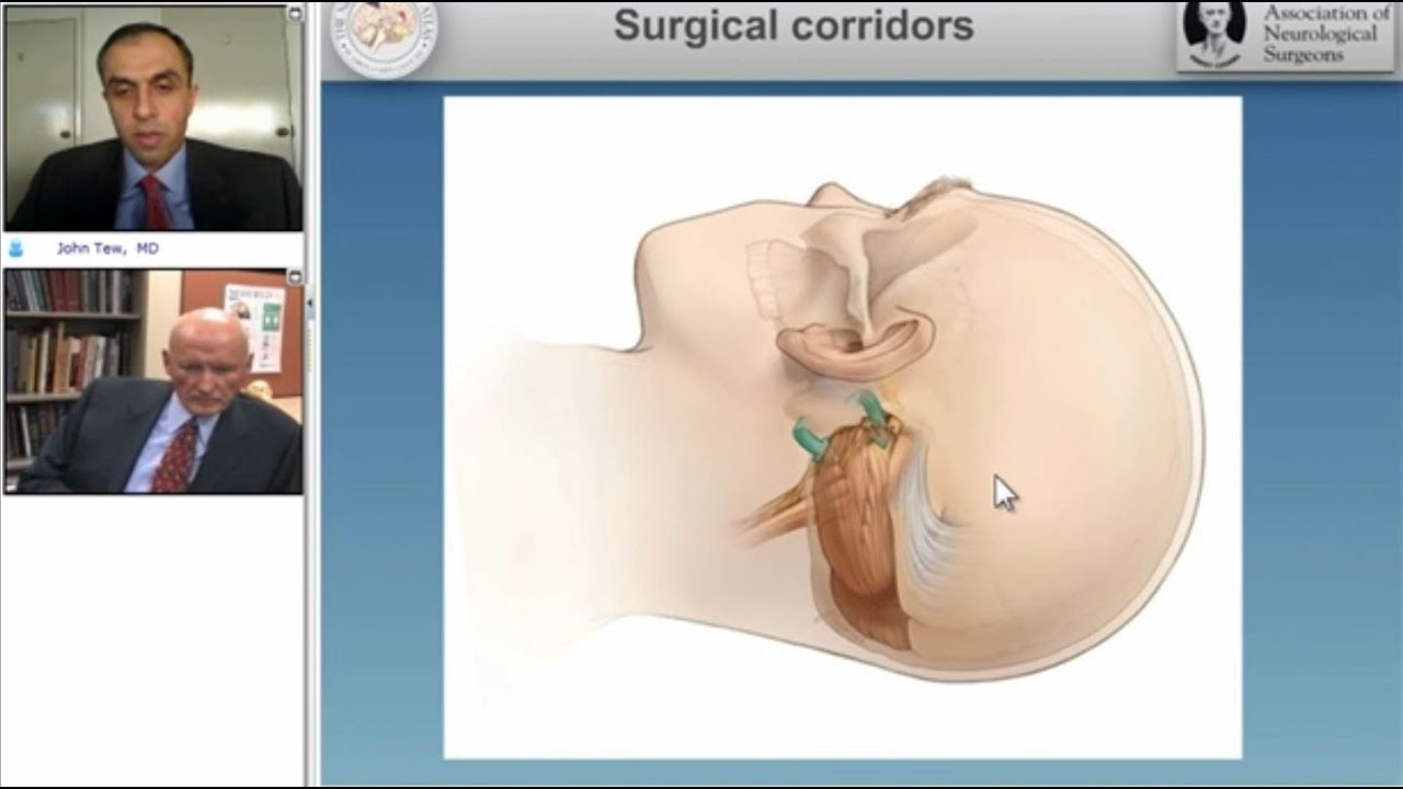 Microvascular Decompression Surgery for Hemifacial Spasm (Preview)