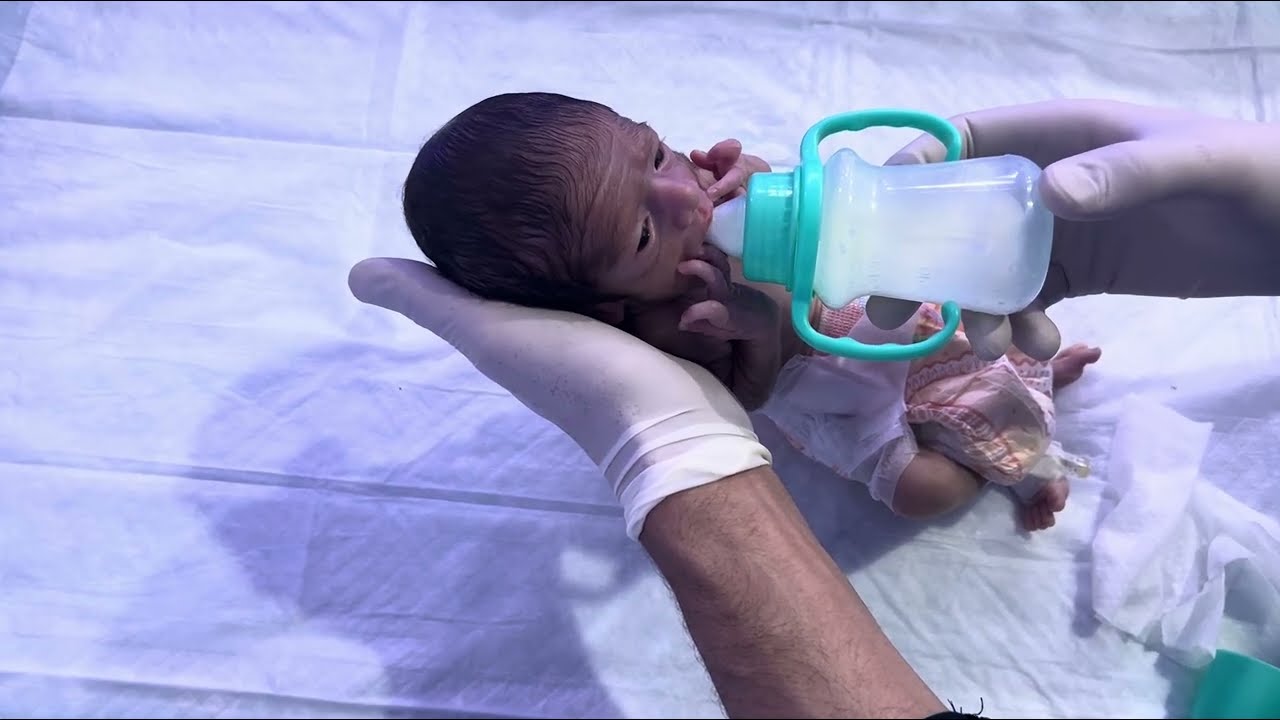 28-Week Premature Baby Part 5  Feeding Battle to Good Feeding  NICU Success Journey