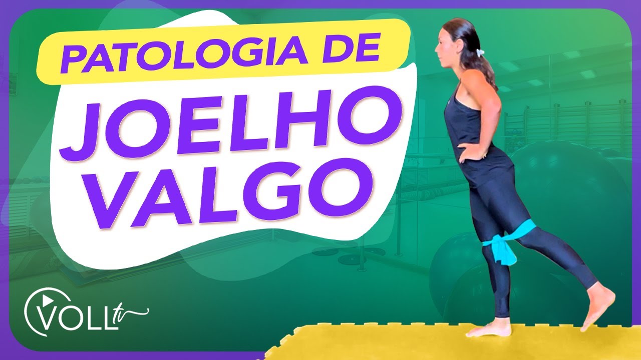 4 exercícios para patologia de joelho valgo