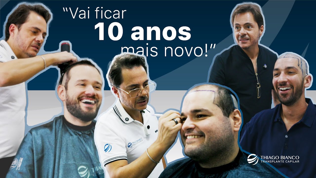 Planejamento é tudo: como defino prioridades no transplante capilar | Dr. Thiago Bianco