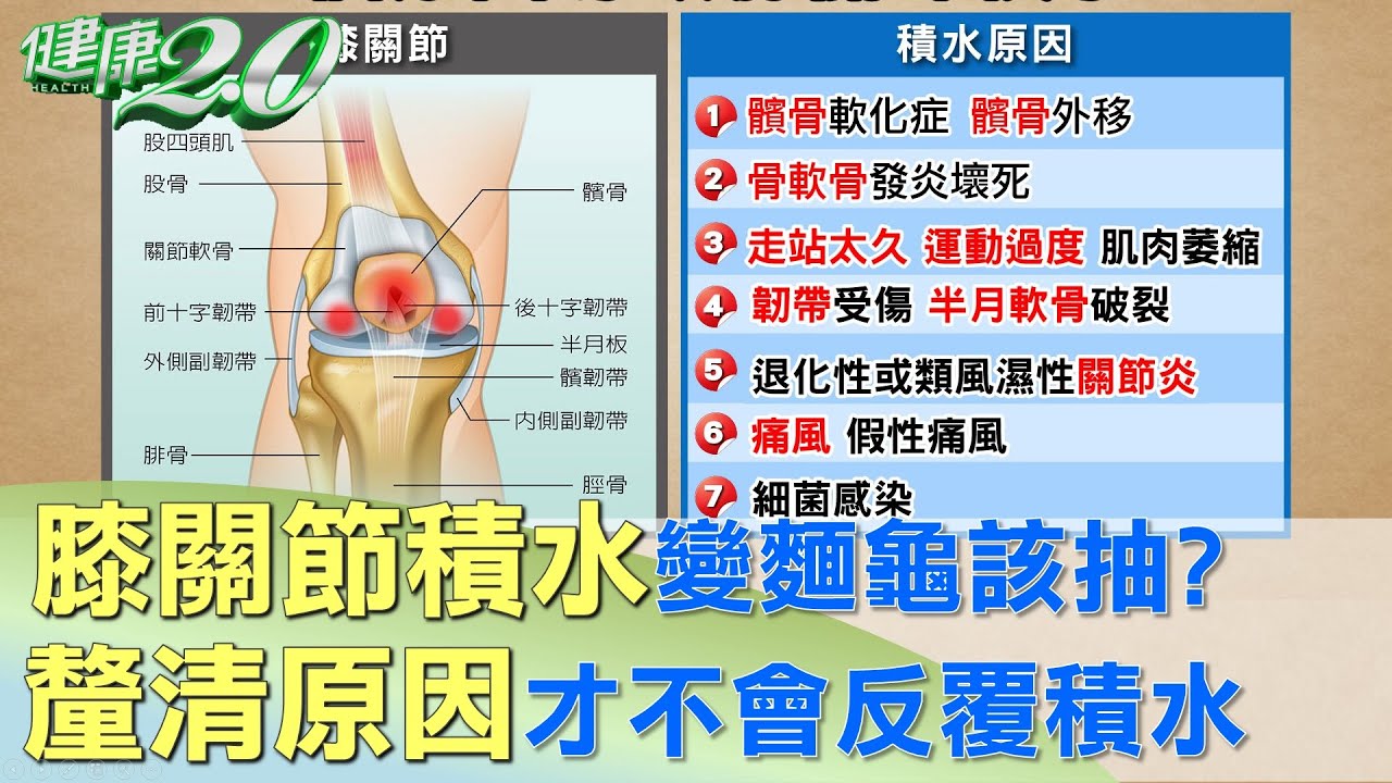 膝關節積水變麵龜該抽？ 釐清原因才不會反覆積水 健康2.0