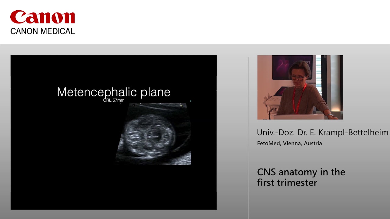 Dr E. Krampl Bettelheim - CNS Anatomy in the First Trimester