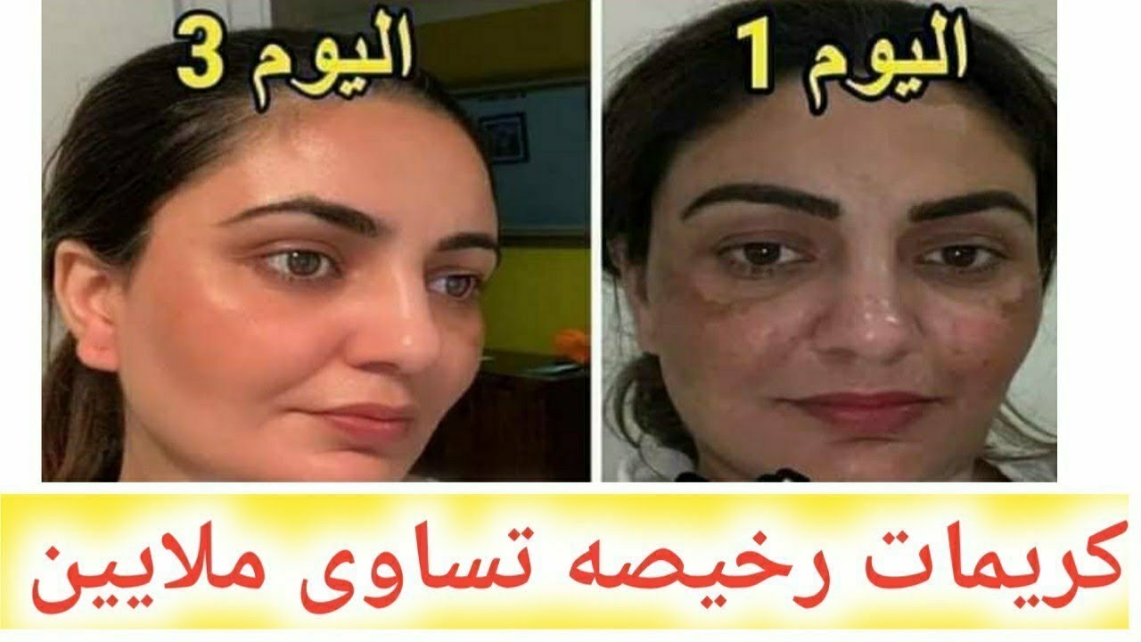 كلهم هيسألوكي: 