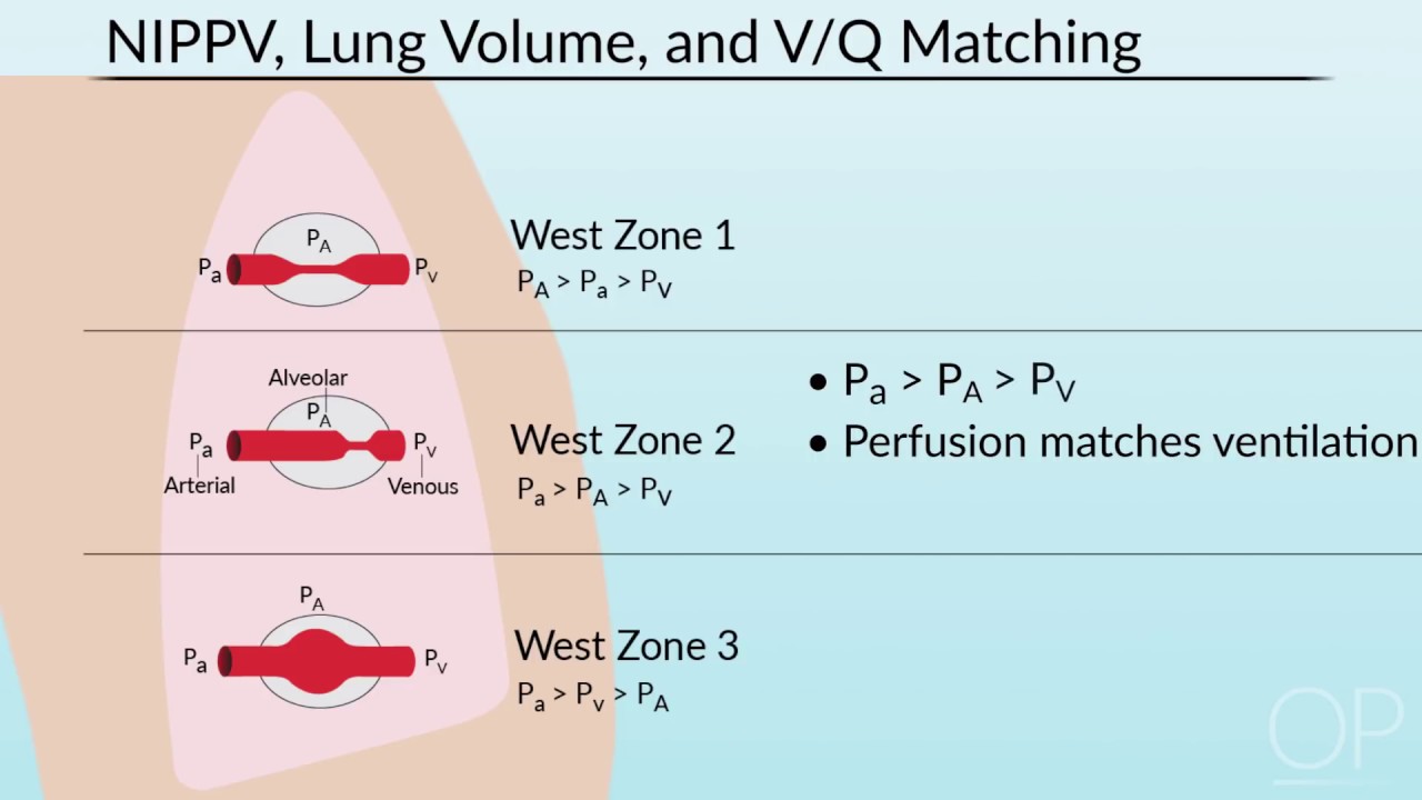 Pulmonary Mechanics in Non-Invasive Positive Pressure Ventilation by B. McAlvin | OPENPediatrics