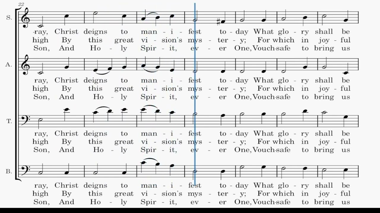 O Wondrous Type! O Vision Fair SATB