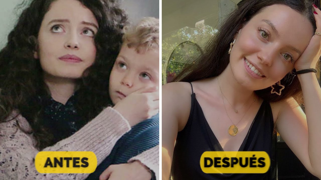 Antes y despues de OMER SUEÑOS ROBADOS