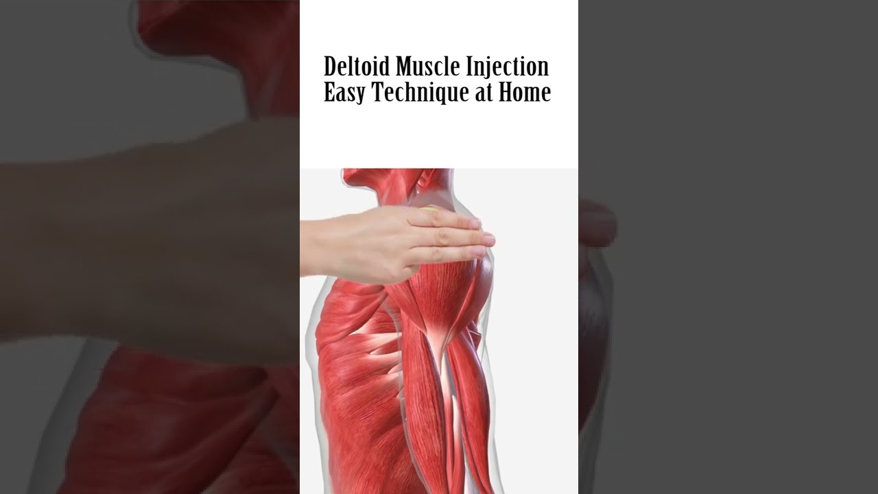how to give deltoid muscle Injection