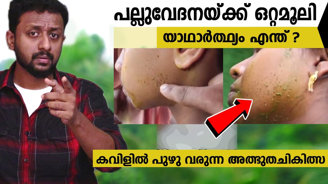 പല്ലുവേദനയ്ക്ക് ഒറ്റമൂലി കവിളിൽ പുഴു വരുന്ന അത്ഭുത  ചികിത്സ/ യാഥാർത്ഥ്യം എന്ത് /Tricks Episode : 152