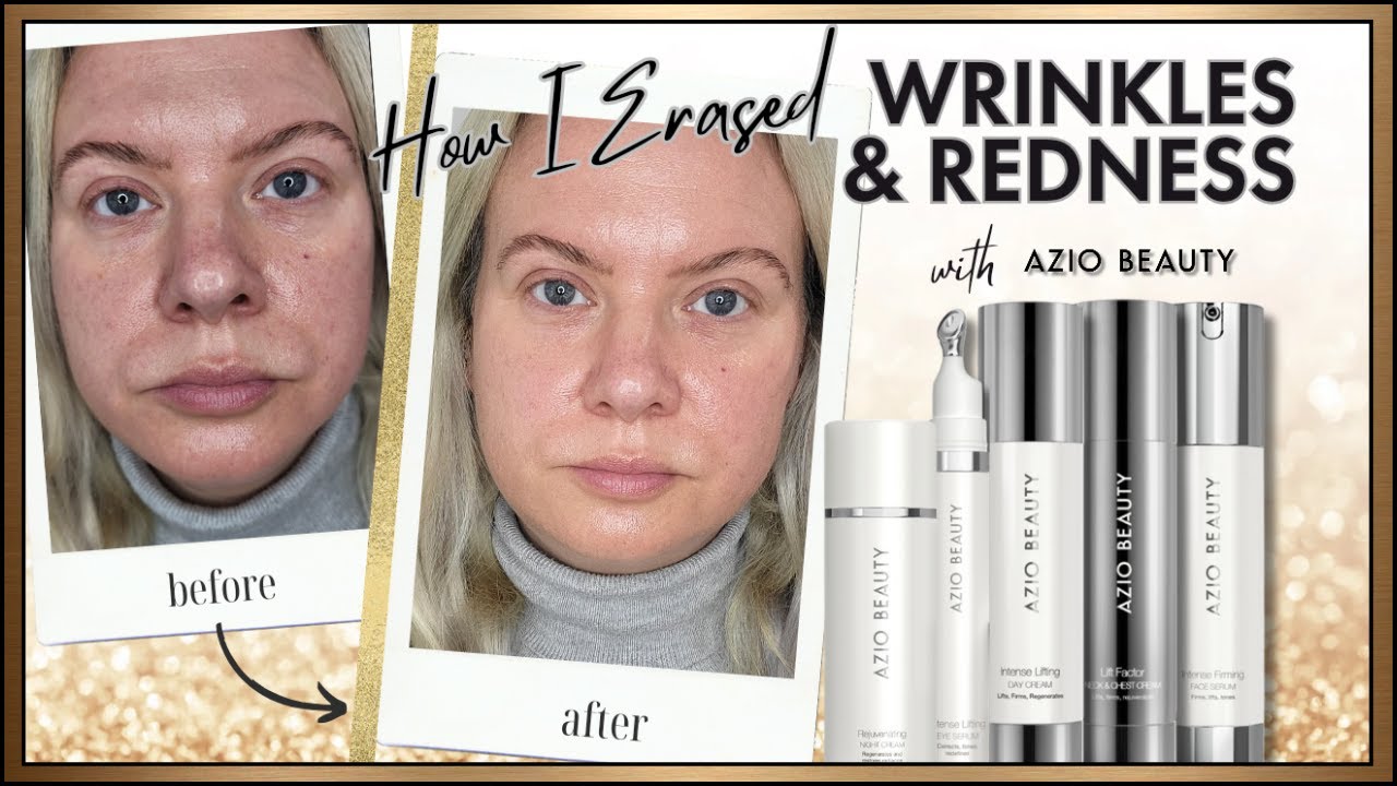 ДО И ПОСЛЕ: КАК AZIO BEAUTY ИЗБАВИЛСЯ ОТ МОИХ МОРЩИН И ПОКРАСНЕНИЙ | Клэр Уолч