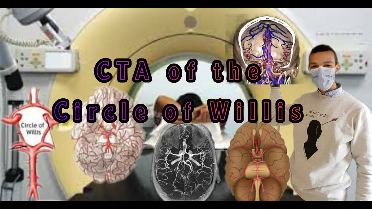 CT Angiography of The circle of Willis. شرايين دائرة وويلز في الأشعة المقطعية #الأشعة
