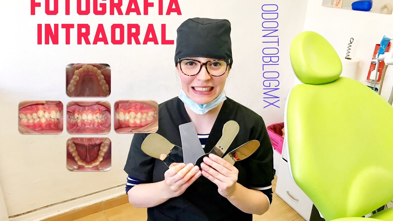 Fotografía Clínica Intraoral