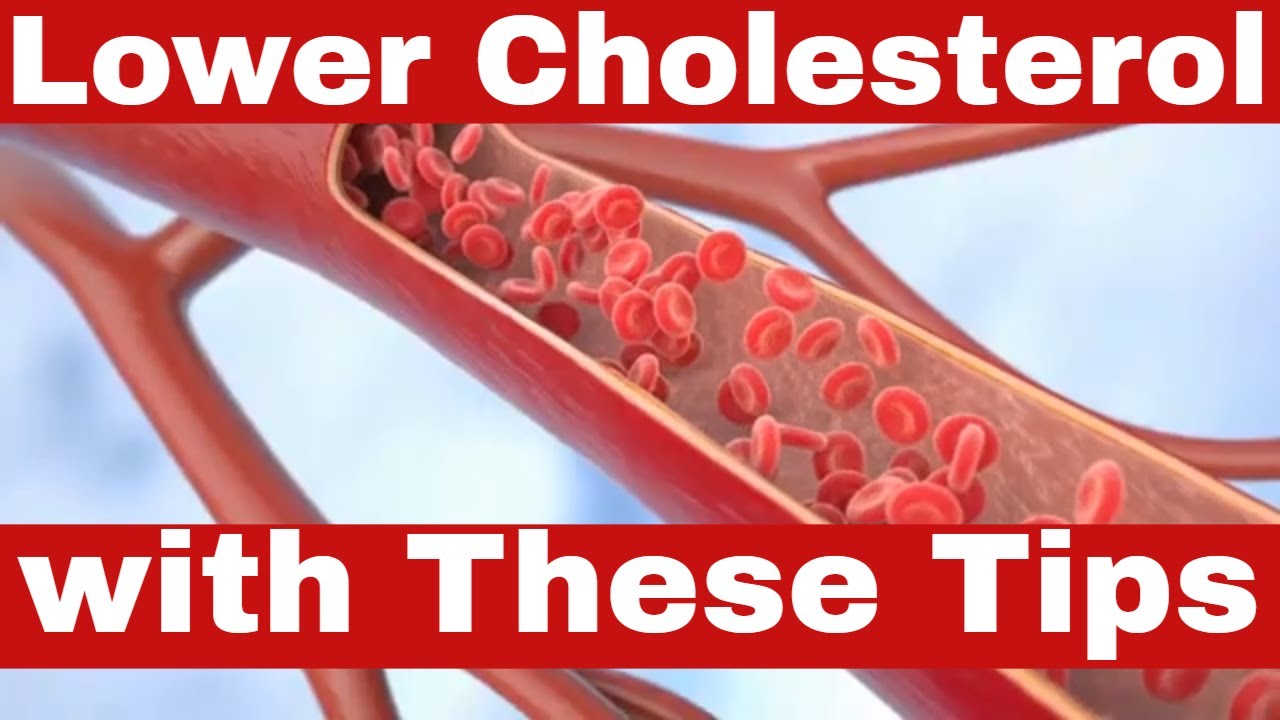 How to Eliminate Cholesterol? Here&rsquo;s How to Lower Your Cholesterol Levels Fast and Naturally!