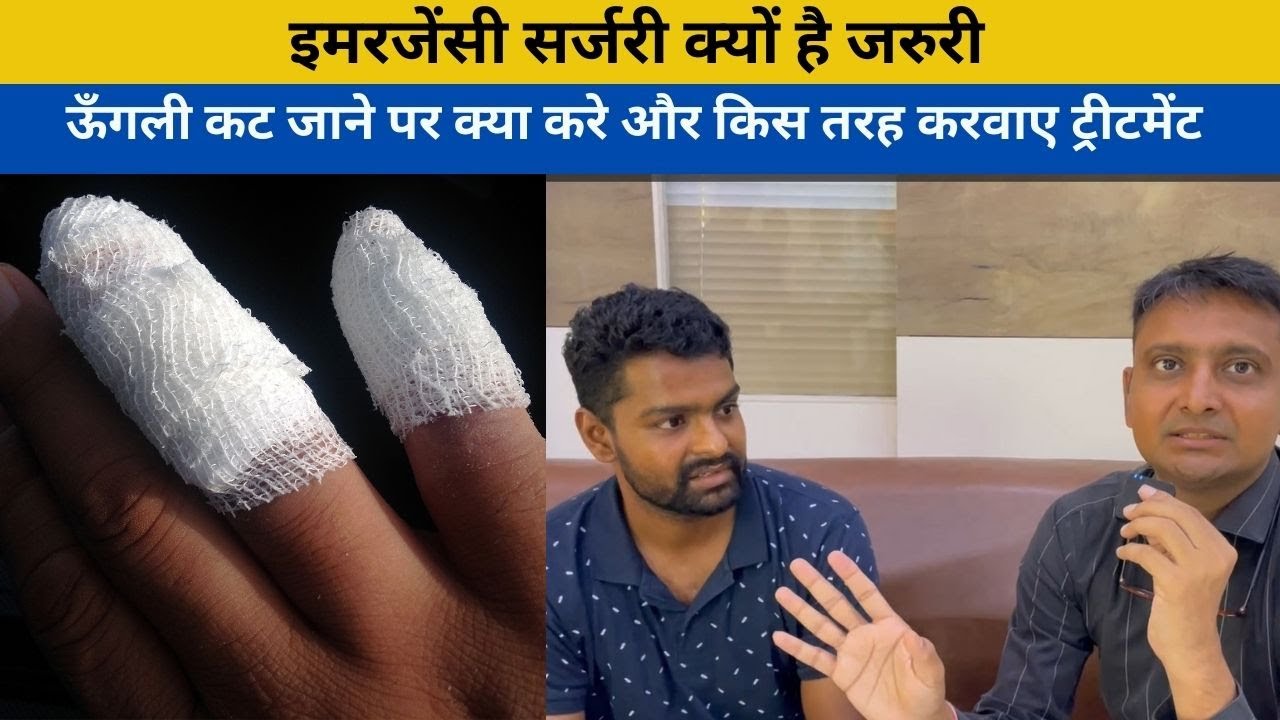 किस तरह ऊँगली कट जाने पर रखे ध्यान क्या करे और किस तरह एक्सपर्ट डॉक्टर के बारे जाने