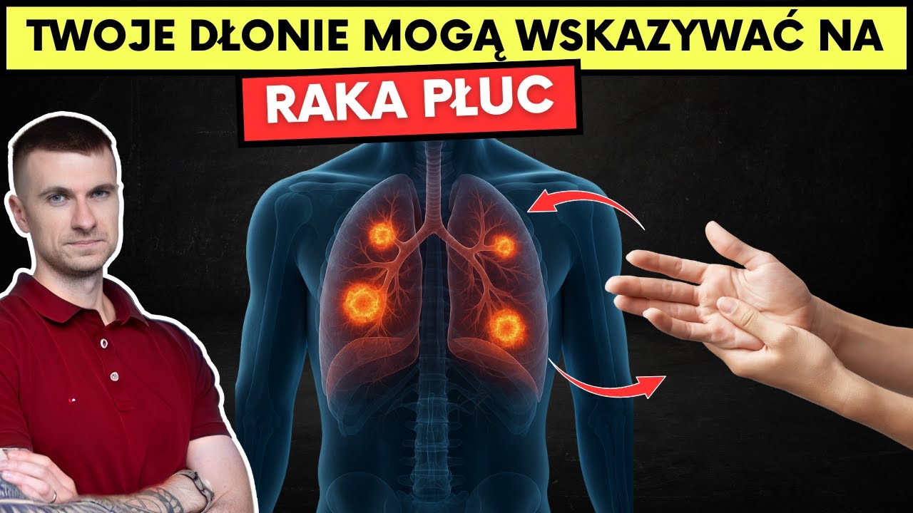 Wczesne objawy raka płuc, które możesz zauważyć. Te 5min może Cię uratować.