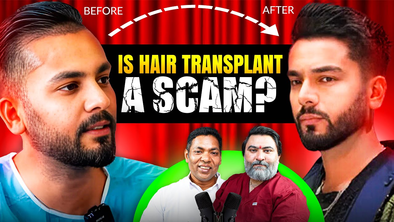 Shocking Facts From His 25 Years of Experience in Hair Transplant | Sagar Shridesh | in Hindi |