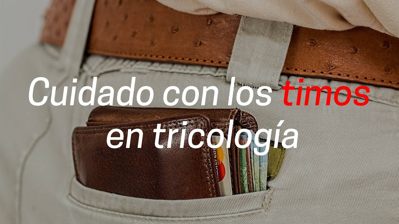TIMOS y ESTAFAS en la CALVICIE