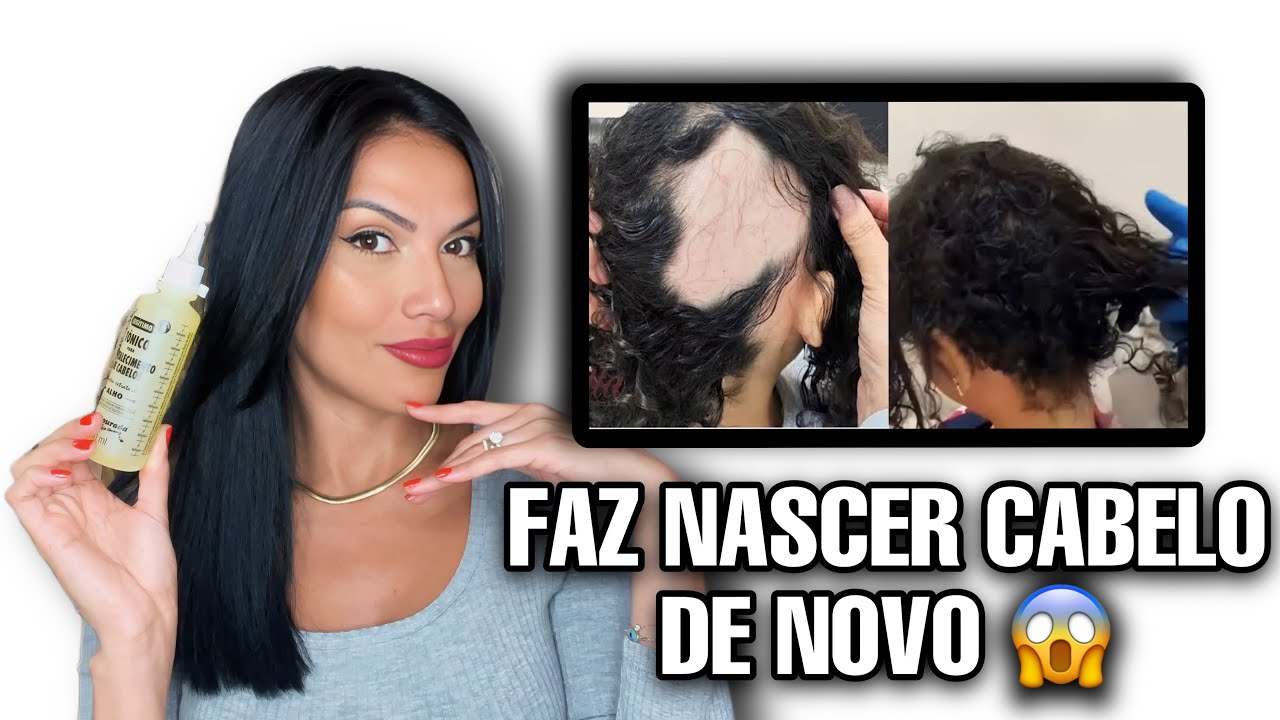 TÔNICO DE ALHO COMO USAR PARA QUEDA E CRESCER O CABELO?FORMA CORRETA TÔNICO TURBINADO!