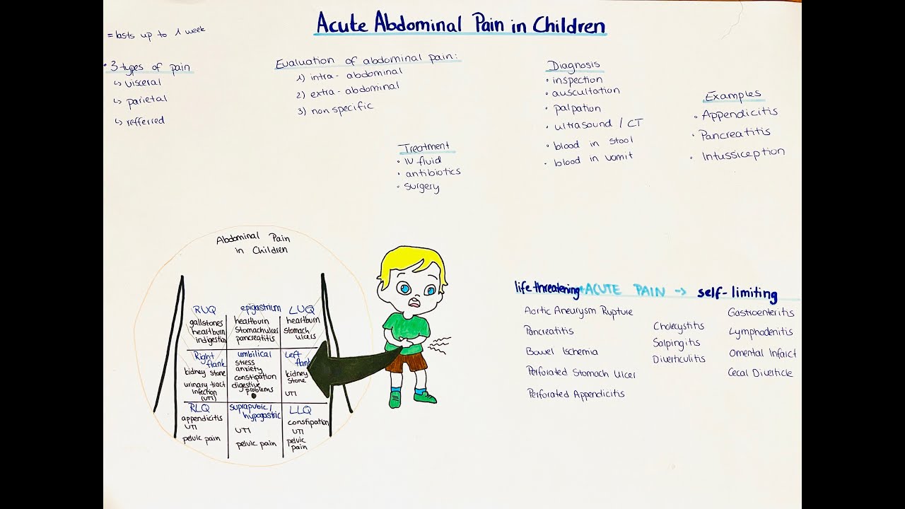 acute abdominal pain in children