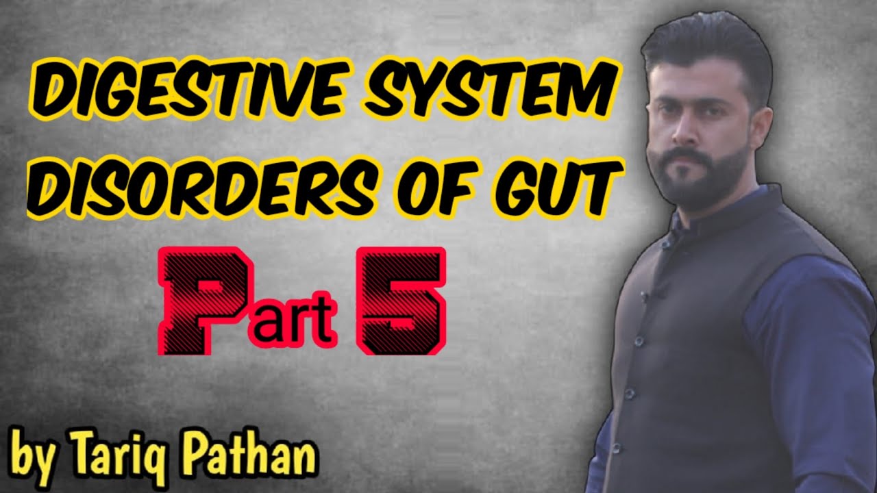 Digestive System - Part 5 ( Disorders of Gut ) - Tariq Pathan