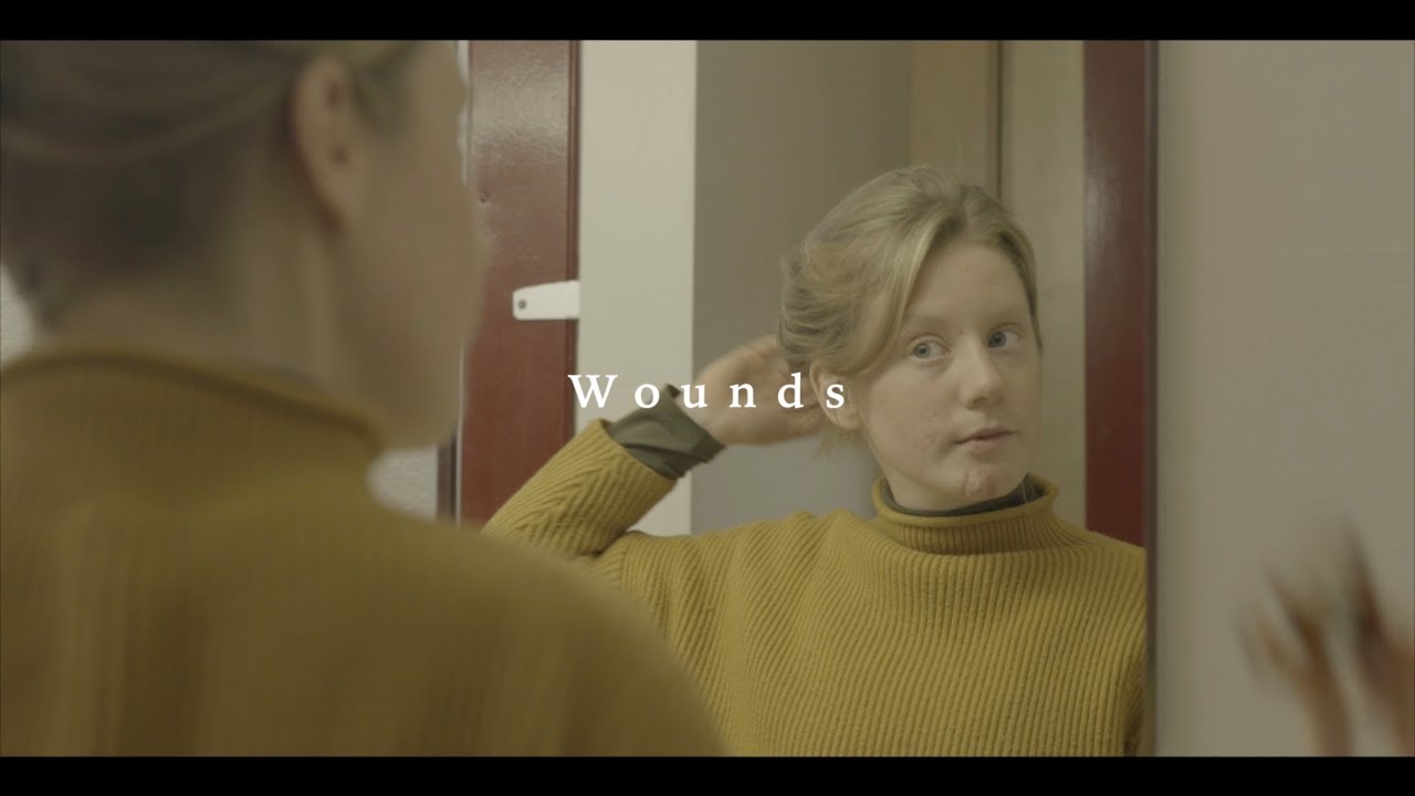 Wounds - Saint Lo.