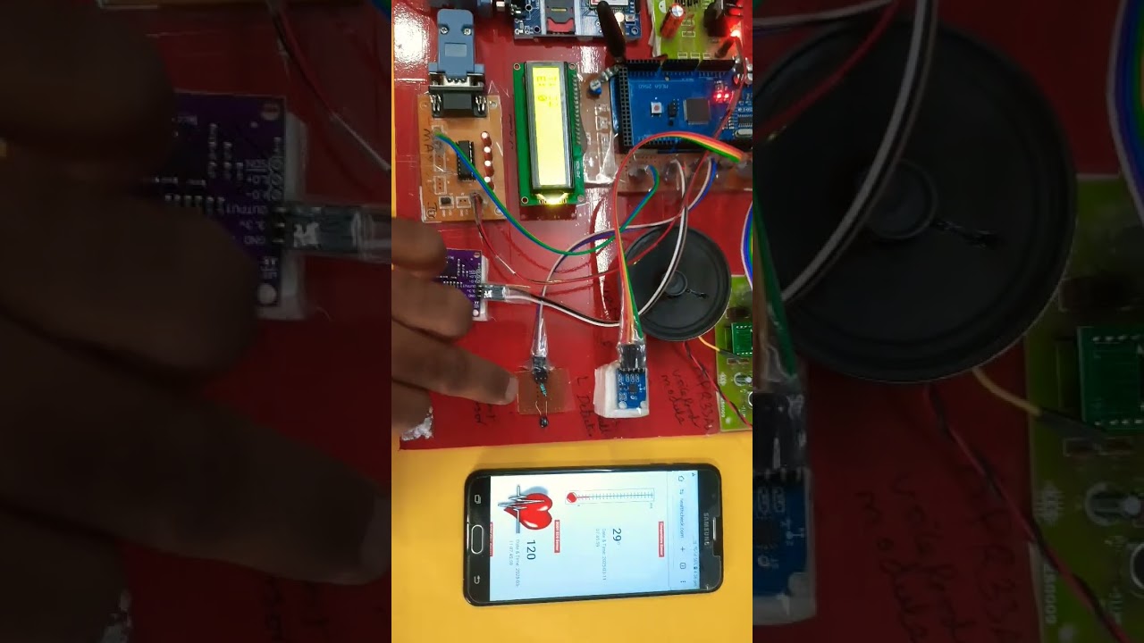 СИСТЕМА МОНИТОРИНГА ЗДОРОВЬЯ ПАЦИЕНТОВ С ПАРАЛИЧОМ НА ОСНОВЕ ИНТЕРНЕТА ВЕЩЕЙ С ИСПОЛЬЗОВАНИЕМ ARD...
