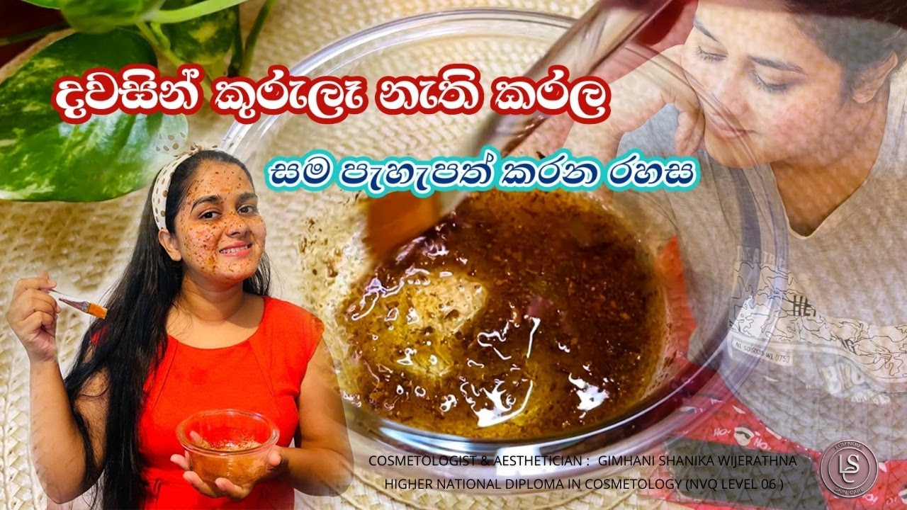 දවසින් කුරුලෑ නැති කරන රහස | Cinnamon And Honey Mask For Acne