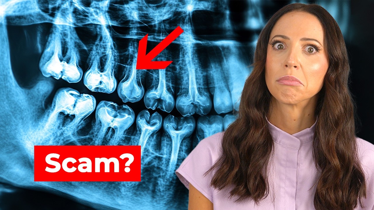 You Probably DON'T NEED Dental X-rays…