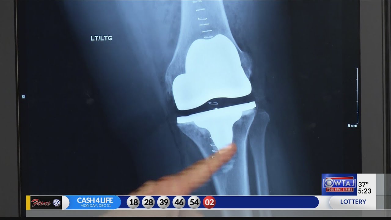 Alternatives to knee replacement
