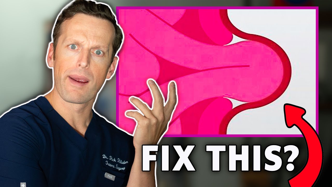 Do you need SURGERY for your HERNIA?