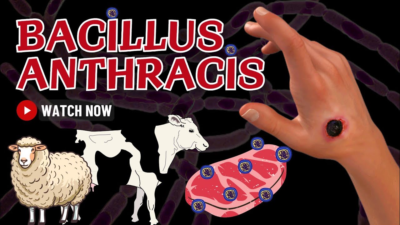 Bacillus Anthracis: Pathogenesis and Clinical Manifestations | A Comprehensive Guide