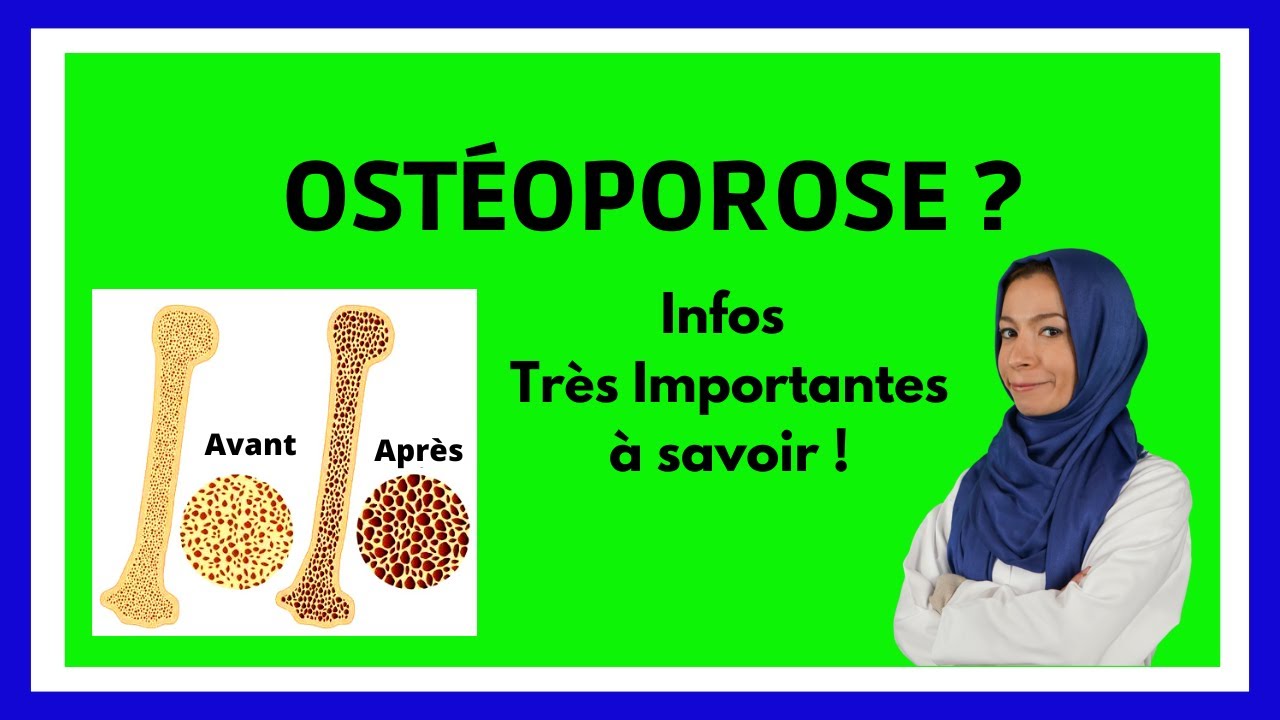 OSTEOPOROSE : Sympt&ocirc;mes, Causes, Traitements / Expliqu&eacute; Simplement