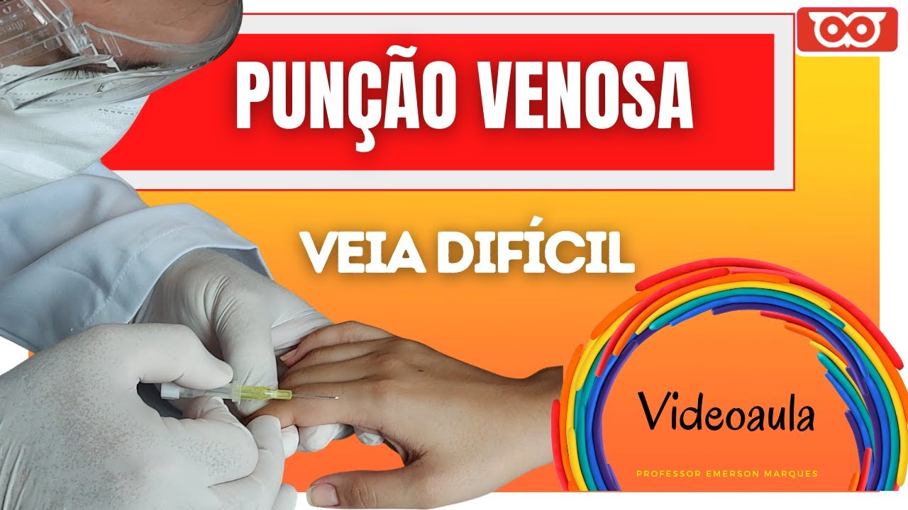 Pun&ccedil;&atilde;o Venosa VEIA DIF&Iacute;CIL