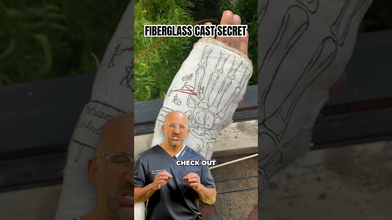 Cast Tip for a Better Broken Bone Experience #shorts