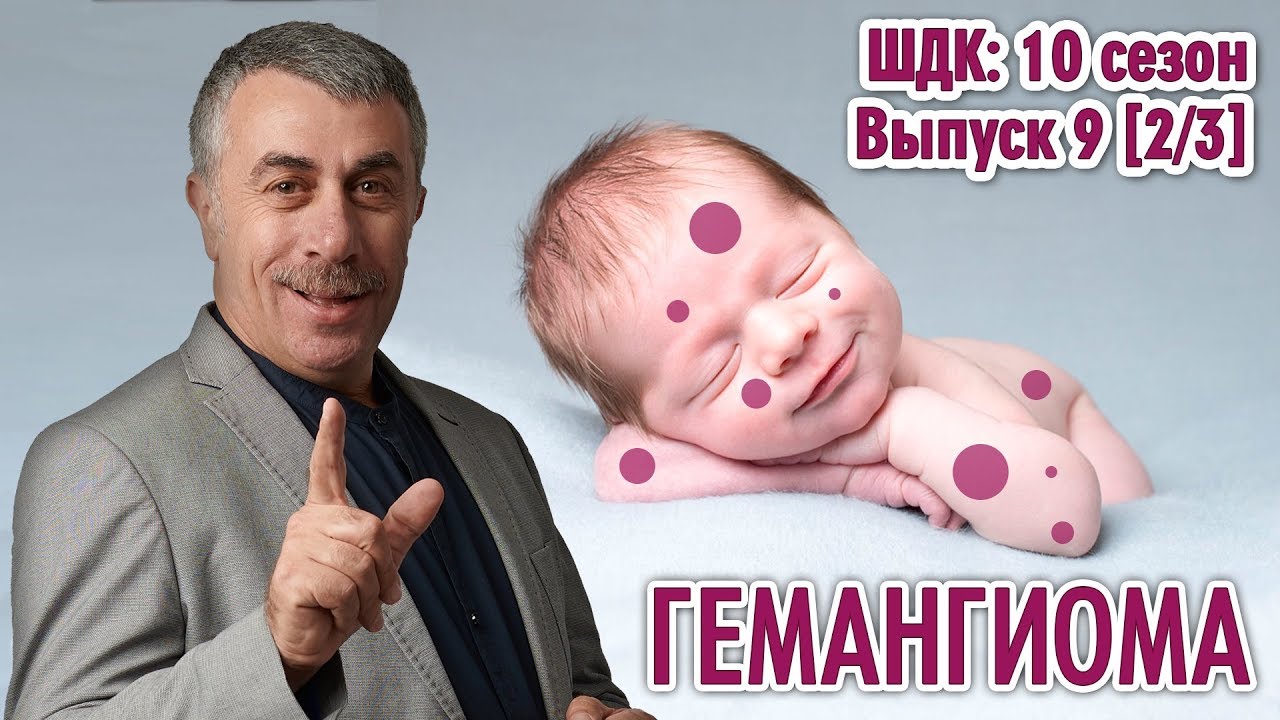 Гемангиома - Доктор Комаровский