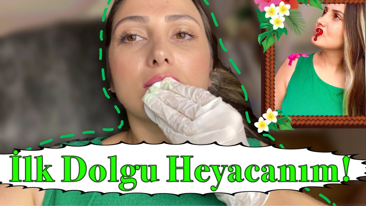 İLK DEFA DUDAK DOLGUSU YAPTIRDIM!(gerilim bitmedi)