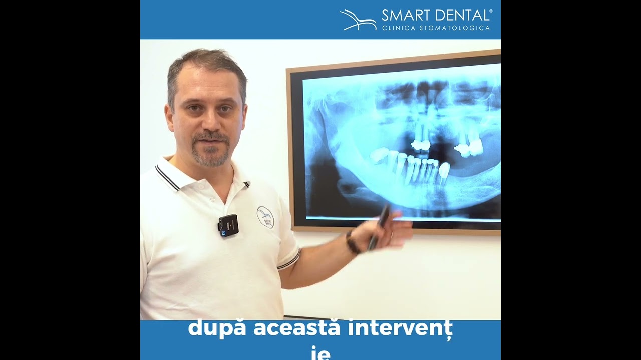 Caz clinic prezentat de Conf. Dr. Bogdan Culic