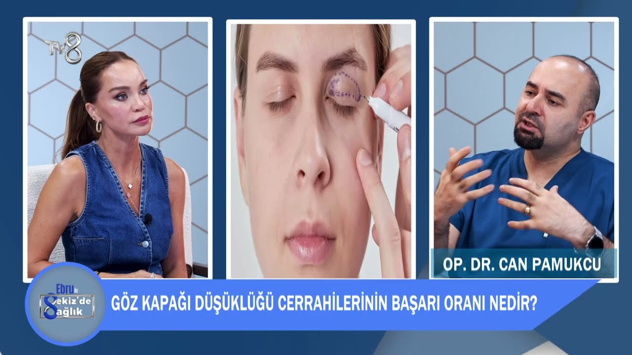 Göz kapağı düşüklüğü 