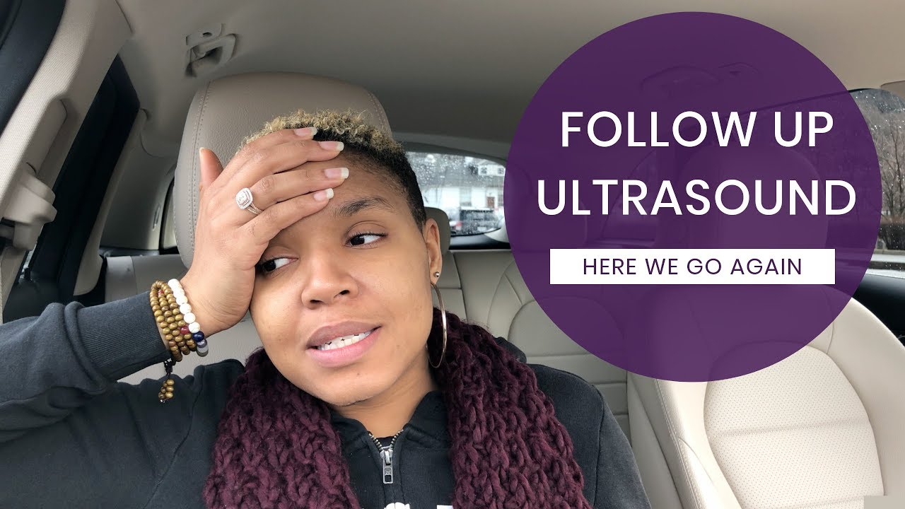 2ND ULTRASOUND APPOINTMENT || WHAT WEEK AM I? || Pregnant With Rainbow Baby #1