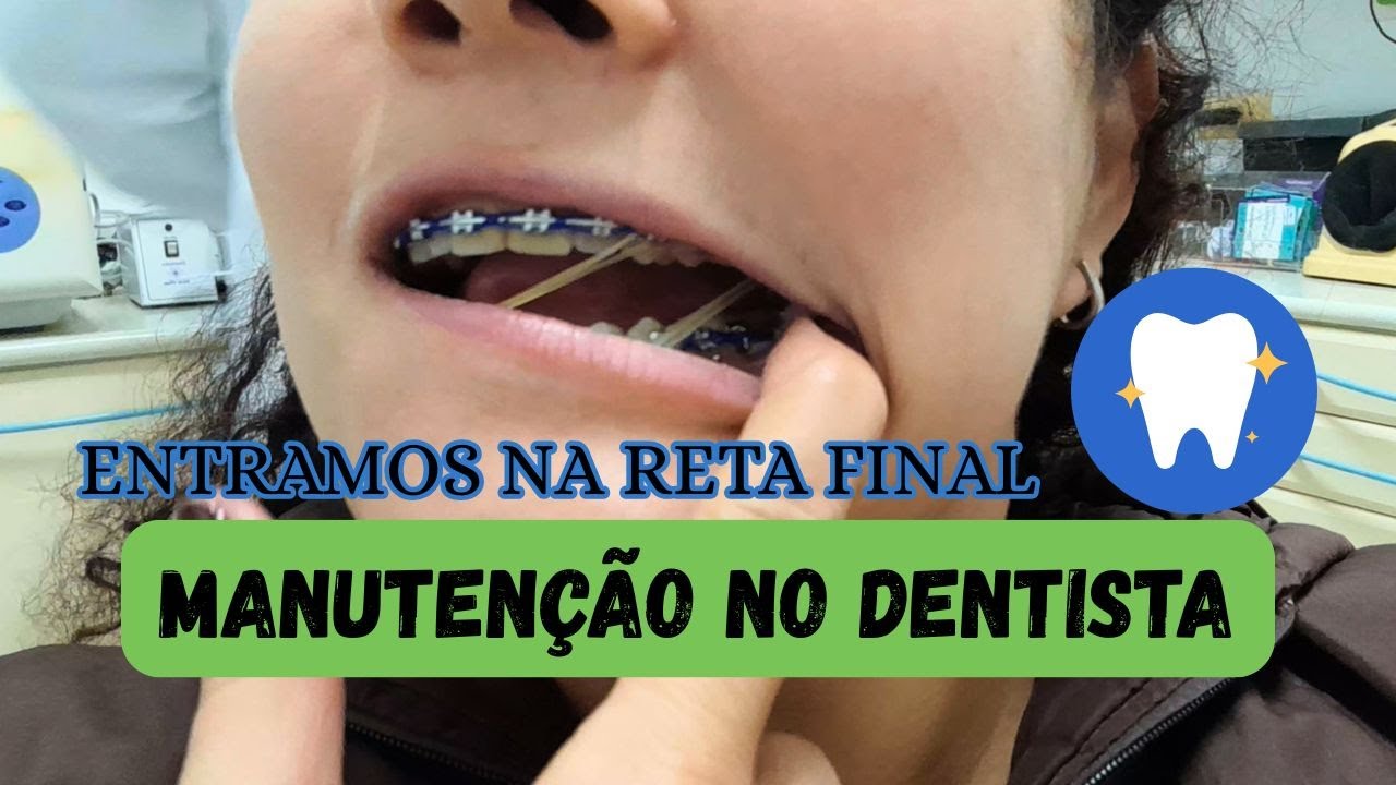 MANUTENÇÃO DO MEU APARELHO NO DENTE #dentista #aparelhoortodôntico #dentes