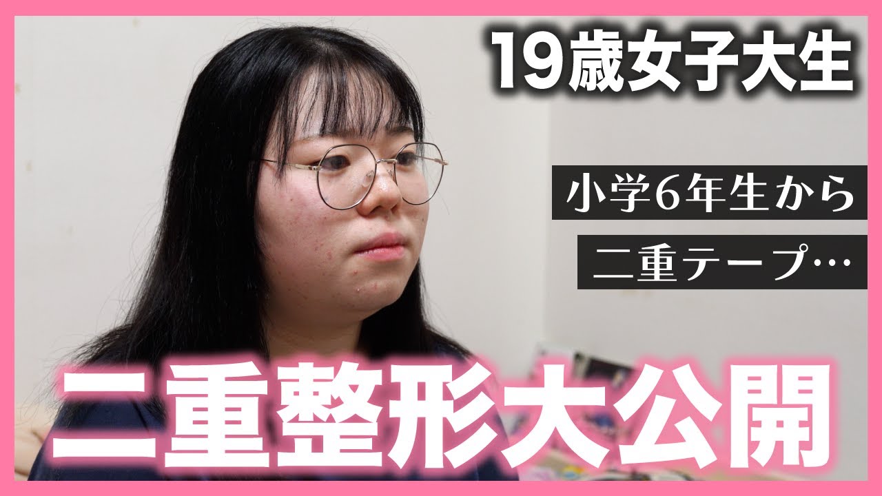 【二重整形・埋没法のリアル第9弾】小学生の頃からのコンプレックスから卒業できるのか！？二重整形のカウンセリング〜手術〜完成まで全て大公開！！