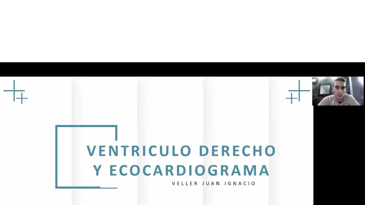 EVALUACION ECOCARDIOGRAFICA DEL VENTRICULO DERECHO