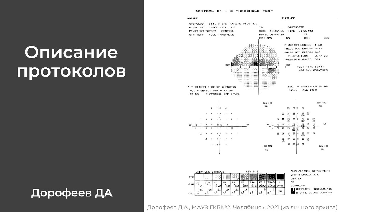 Описание протоколов исследования поля зрения