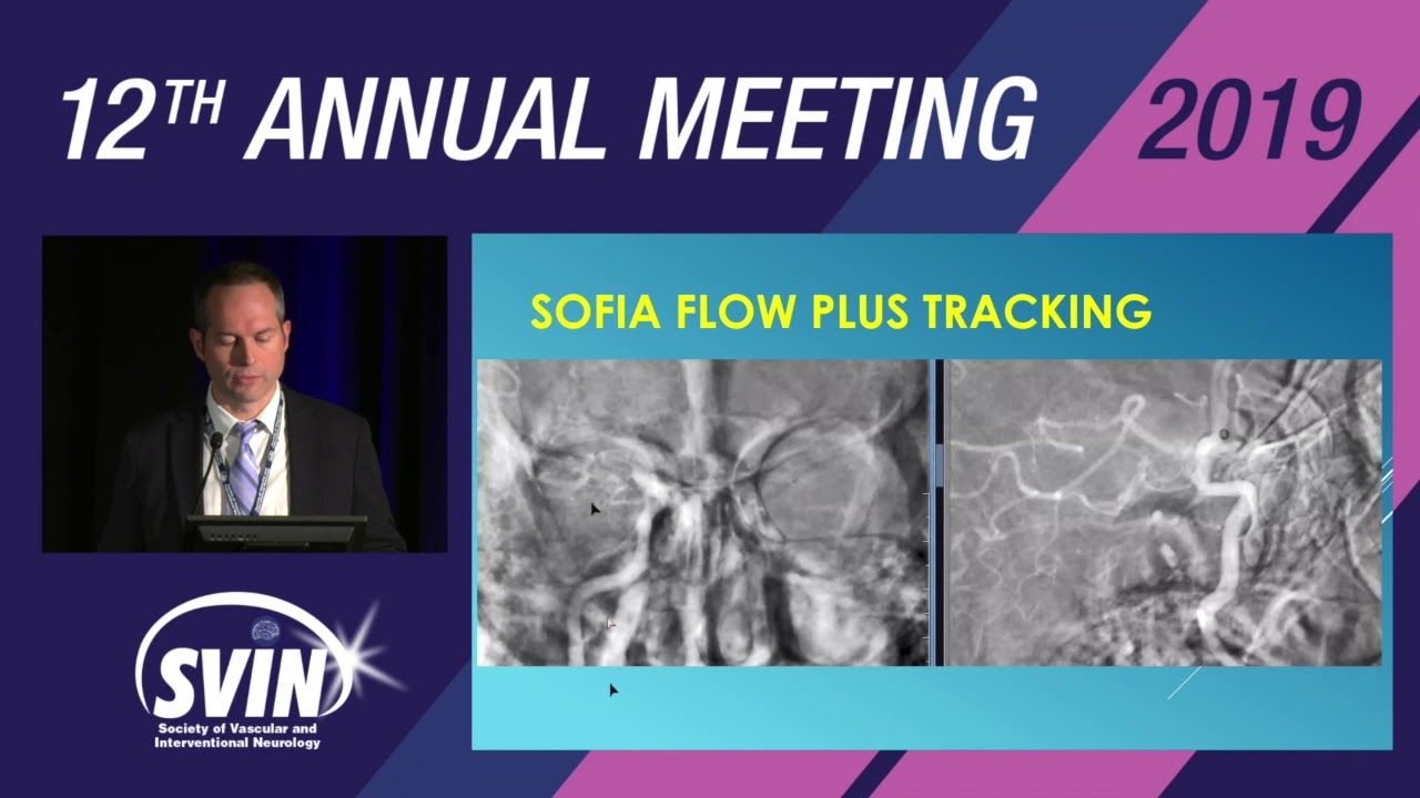 SVIN 2019: SOFIA Flow Plus Aspiration Catheter First-Line Thrombectomy Approach