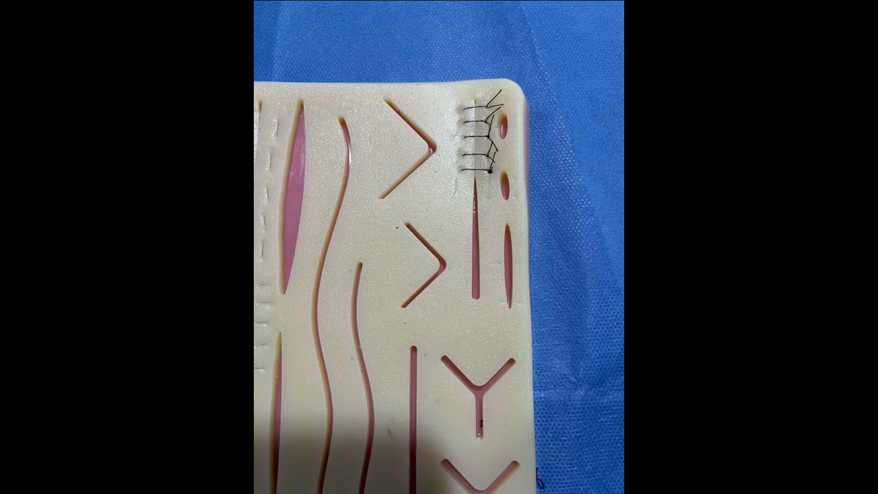 TALLER DE SUTURAS- COLCHONERO VERTICAL Y HORIZONTAL, PUNTO SIMPLE, INTRADÉRMICA Y EN COLGAJO 