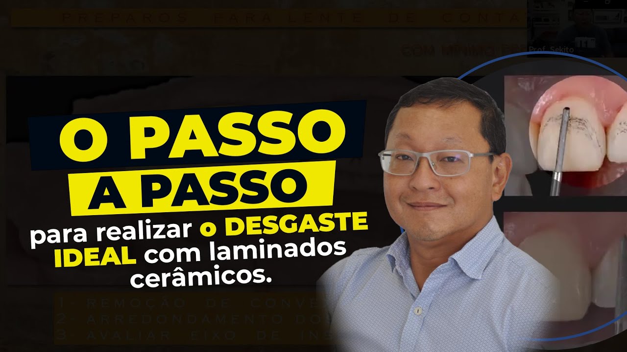 O passo a passo para realizar o desgaste ideal com laminados cer&acirc;micos