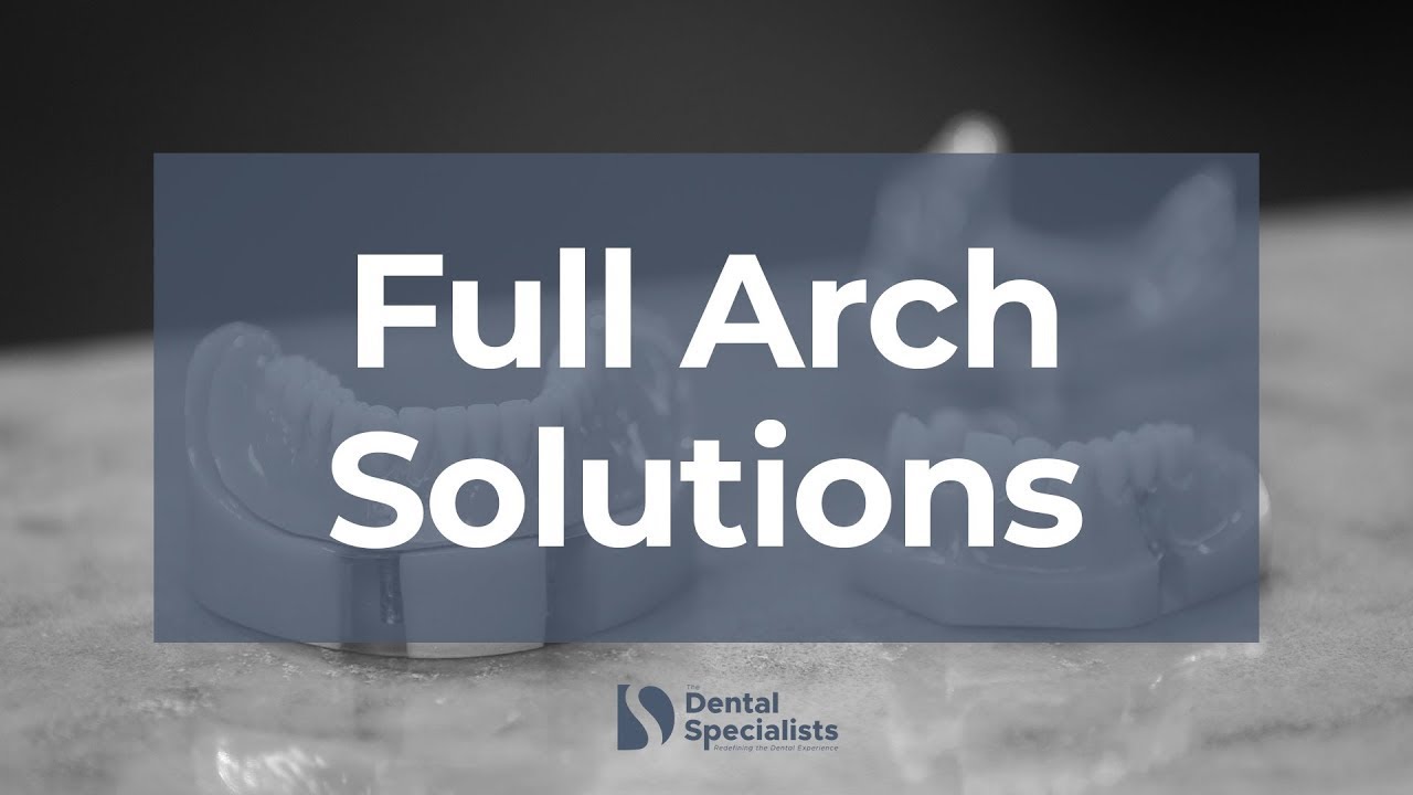 Your Full Arch Options & What's Best for You