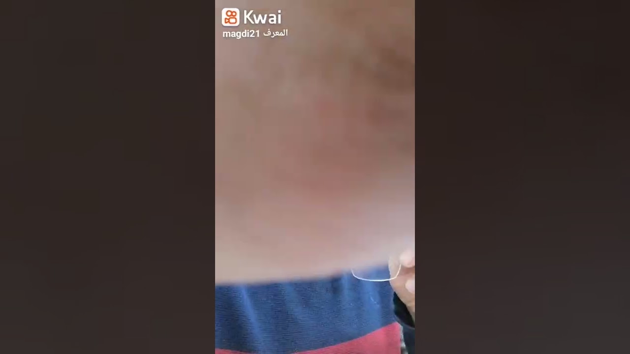 العدسات المتدرجه البايفوكل والمالتي فوكل البروجرسف