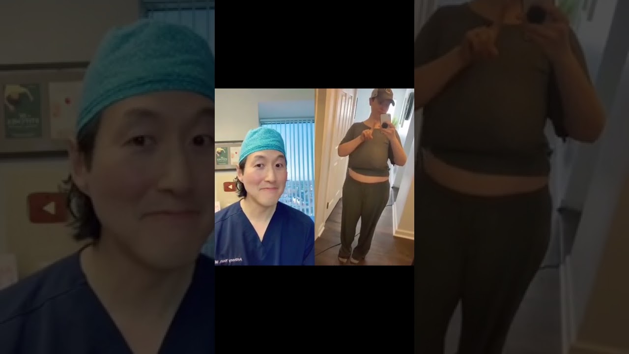 My Patient&rsquo;s Breast Reduction Journey! #shorts #breastreduction